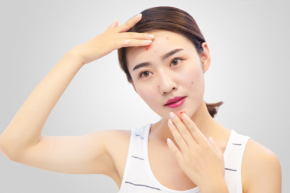 問(wèn)題性肌膚該如何解決改善呢？