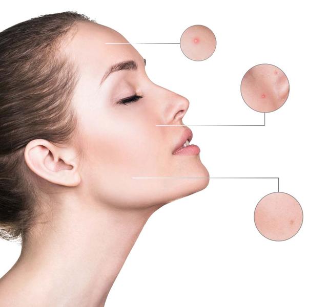 敏感肌自救指南：開啟溫柔呵護之旅