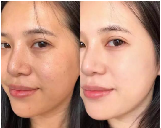 膚色暗沉救星！4個快速提亮肌膚的實用方法