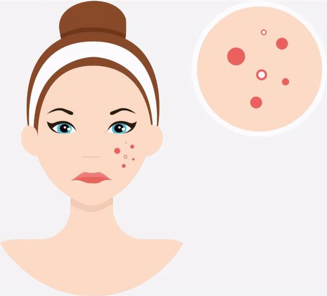 換季護膚攻略，拒絕春夏換季敏感爛臉