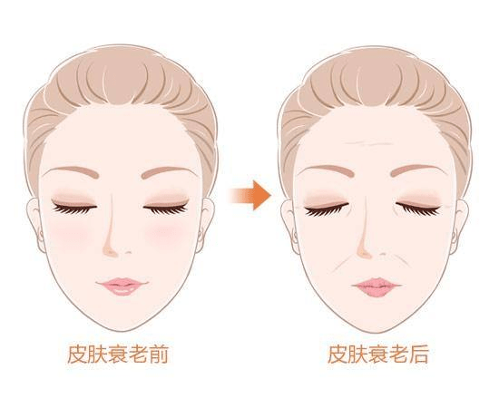 肌膚衰老預警！這些信號正在悄悄顯現