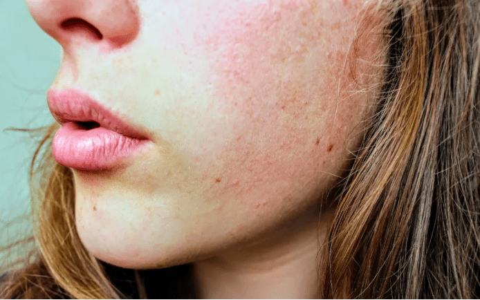 別再瞎護膚了！一文講清問題肌根源與解決辦法