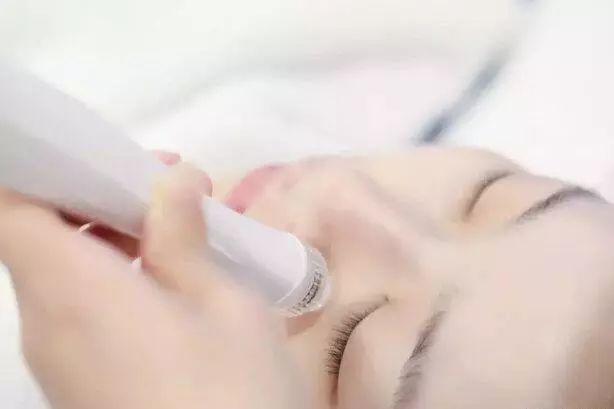 告別草莓鼻！3步科學去黑頭