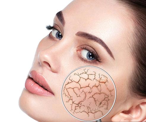 敏感肌換季自救，養出“耐打”好皮膚