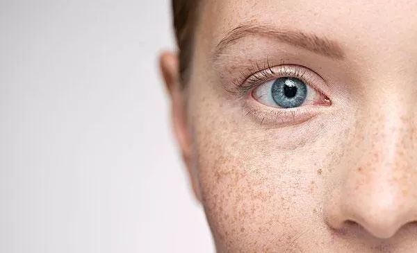 告別“臟臉”困擾！科學清雜質，養出干凈素顏肌