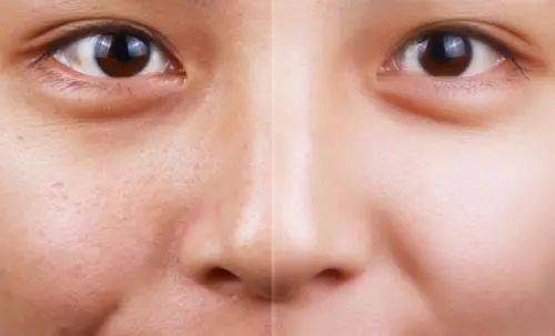 春天一曬就黑？踏青出游護(hù)膚指南